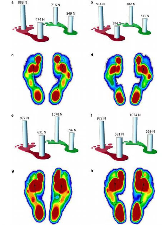 исследования 3D-печати индивидуальной пяточной стельки 2