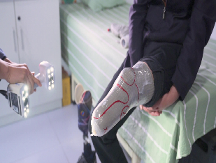 3D-сканер EinScan H2 для сканирования раструбов