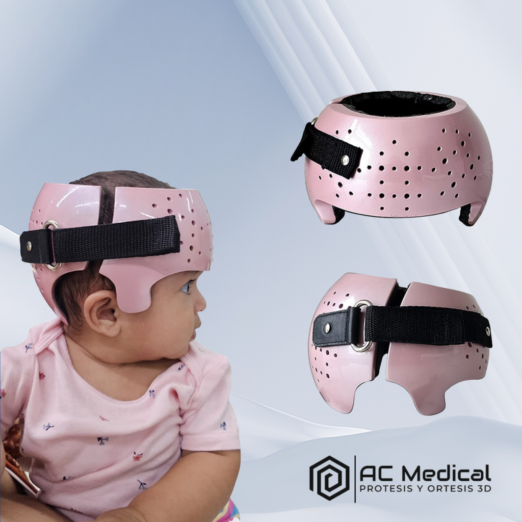 Черепной ортез Helmet-Head V2