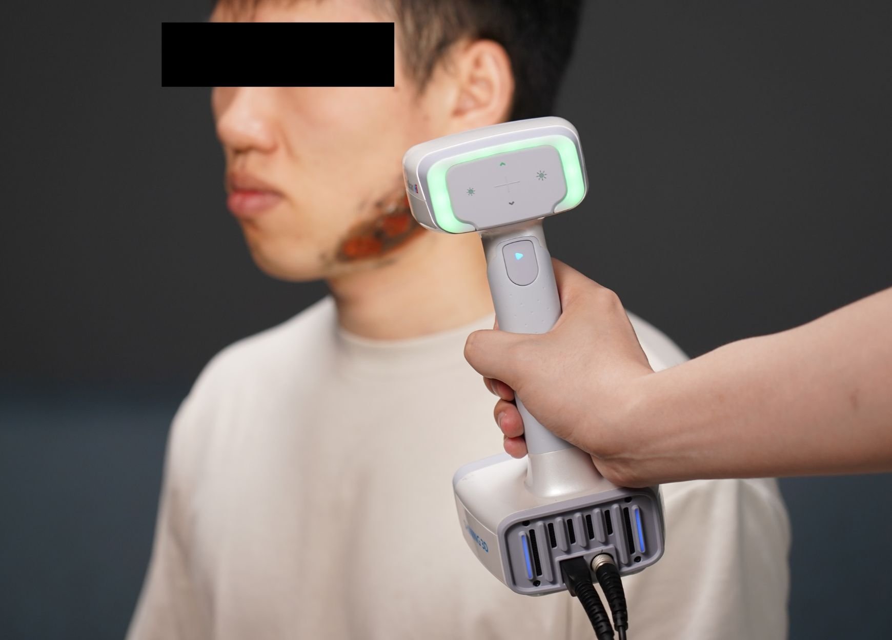 Уход за ранами и лечение ожогов