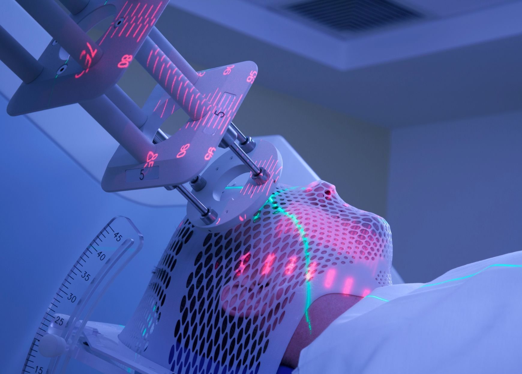 Лучевая терапия