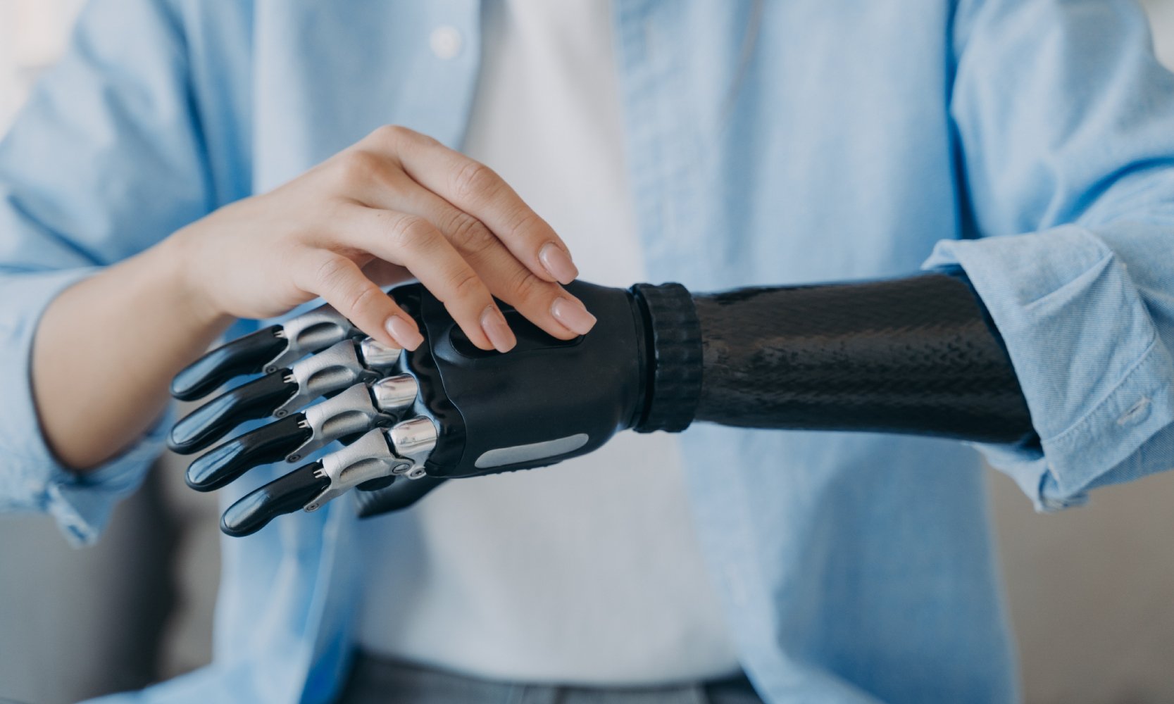 Протез верхней конечности