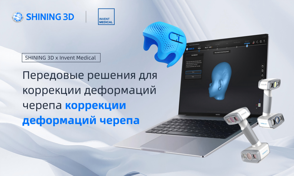Компании SHINING 3D и Invent Medical готовы предложить передовые решения для коррекции деформаций черепа