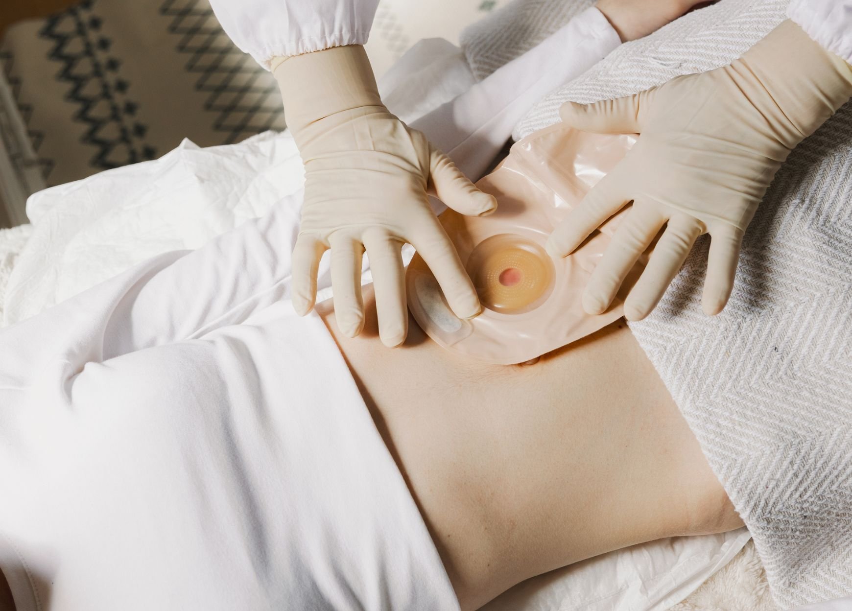 Индивидуальные средства по уходу за стомой